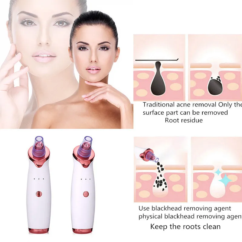 Blackhead Remover | Acne Vacuum Suction | Face Cleaner | Black Head Pore Cleaning Beauty Skin Care Tool